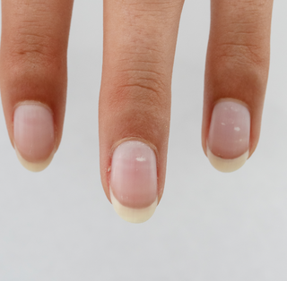 Witte vlekjes op de nagels? Drink meer melk!